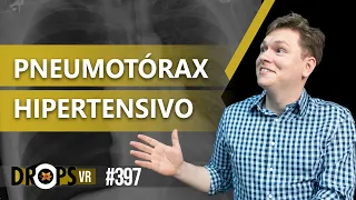 PNEUMOTÓRAX HIPERTENSIVO - COMO IDENTIFICAR NO RX