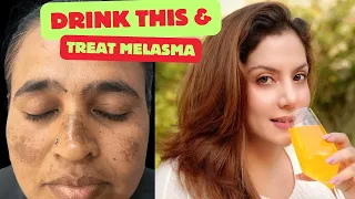 Drink this to treat Melasma & Pigmentation | Nipun Kapur