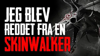 Jeg Blev Reddet Fra En Skinwalker - Dansk Creepypasta