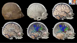 THE EANS WEBINAR: EMERGING TECHNOLOGIES AND INNOVATIONS IN NEUROSURGERY