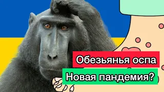 Обезьянья оспа. Новая пандемия?