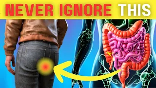 CRITICAL Colon Cancer Symptoms You Should NEVER Ignore| Longevity Deprocessed