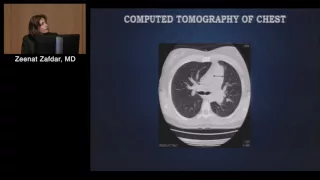 Pulmonary Imaging: Techniques for Pulmonary Hypertension Diagnosis (Zeenat Safdar, MD)