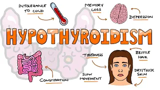 Hypothyroidism Signs and Symptoms Mnemonic - MOMS SO TIRED
