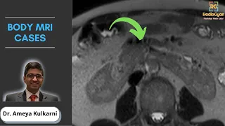 MRI Case-based Review | Dr. Ameya Kulkarni | Sep 2021