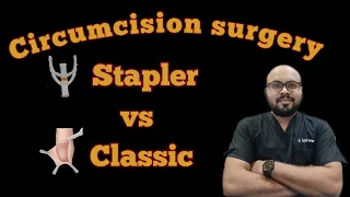 circumcision surgery ZSR stapler vs classic | which surgery is better stapler or classic?
