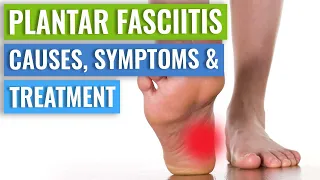 Plantar Fasciitis Causes, Symptoms & Treatment