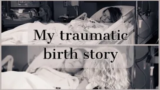 TRAUMATIC BIRTH STORY |SURVIVING AN AMNIOTIC FLUID EMBOLISM | AMBER STOFEL