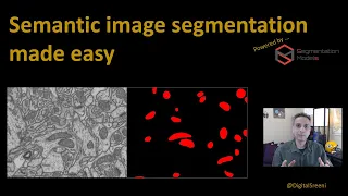 177 - Semantic segmentation made easy (using segmentation models library)