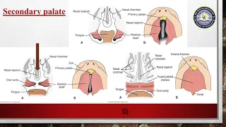 Medical Embryology | Head and neck Development | Tongue| Thyroid gland | Face | Nasal cavity | Teeth