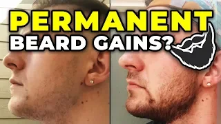 PROOF That Minoxidil Beard Gains Are PERMANENT After Stopping!?