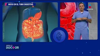 Moco en el sistema digestivo: intestino, colón y más | Visita de Doctor
