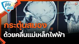 กระตุ้นสมองด้วยคลื่นแม่เหล็กไฟฟ้า รักษาผู้ป่วยซึมเศร้าดื้อยา | รู้ทันกันได้ | วันใหม่วาไรตี้