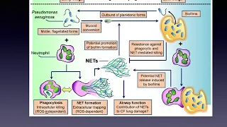 Pseudomonas Aeruginosa in Chronic Lung Infections