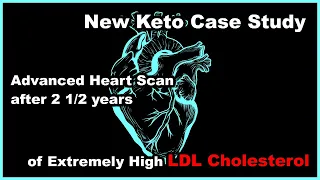 New Case Study - High LDL Cholesterol, Low Saturated Fat, But What About Heart Disease…?