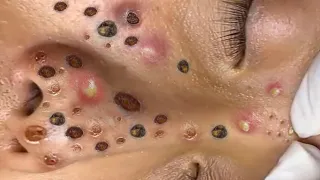 Make Your Day Satisfying with An Popping New Videos #18