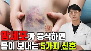 암이 자라나기 시작할때 우리 몸이 보내는 '암의 위험신호 5가지' 가 있습니다 (대장암, 췌장암, 폐암, 간암의 위험신호는???)