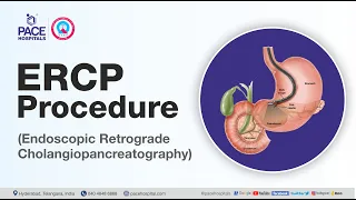 What is ERCP Test and How it is done? | Department of Gastroenterology - Pace Hospitals