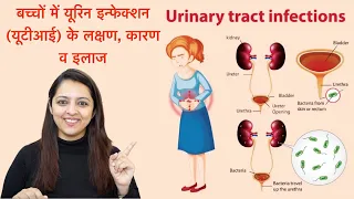 Urinary Tract Infection (UTI) in Kids: Causes, Symptoms & Treatment | बच्चों में यूरिन इन्फेक्शन