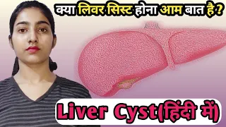 liver cyst kya hai|what is liver cyst|causes|symptoms|treatment|Msn|