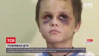 Внаслідок ДТП у Вінницькій області двоє дітей тяжко травмувалися і залишися без опікунів