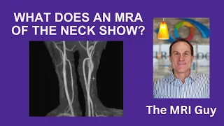 What does an MRA neck show?