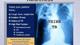 Management of Tuberculosis in Emergency Department Settings