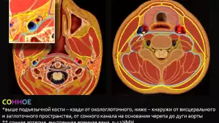 КТ диагностика рака шеи, часть 1, введение, анатомия