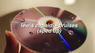 ✰ lewis capaldi - bruises (sped up) ✰