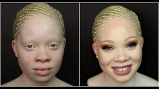 Amazing make-up transformation on Albino Skin