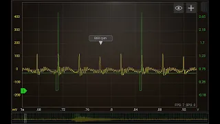 HSCOPE 402 - DIAGNOSTICO DE INYECTORES POR MEDIO DE SENSOR DE PULSOS.