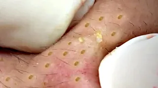 Most Satisfying and Relaxation with An Spa Video #100