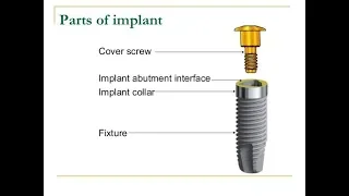 PARTS OF DENTAL IMPLANT