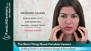 The Danger of Porcelain Veneers