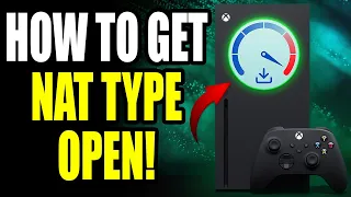 How to Get NAT Type Open on Xbox Series X/S - Faster Downloads, Lower Ping and Fix LAG!
