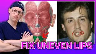 Uneven Lower Lip and How To Fix It |  Surgeon Reacts