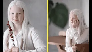 Чеченская школьница-альбинос поразила людей своей необычной красотой – восхищается весь мир!