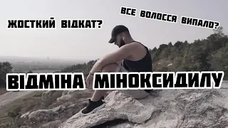 ВІДМІНА ТА ВІДКАТ ВІД МІНОКСИДИЛУ