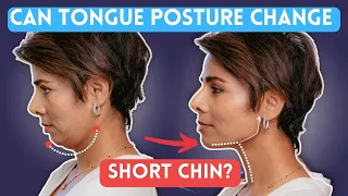 MEWING: Change TONGUE POSTURE for Defined Jawline /Face yoga for Face Shape (Episode-1)