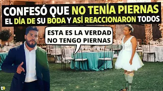 Confesó que no tenía piernas el día de su boda y así reaccionaron todos.