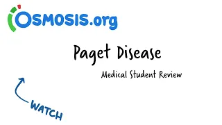 Paget Disease: Osmosis Study Video