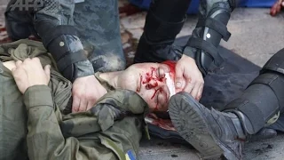 Ukraine: Dozens injured, one killed in blast outside Kiev parliament building