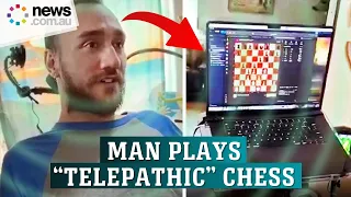 Patient with Elon Musk’s Neuralink brain-chip uses ‘telepathy’ to play chess