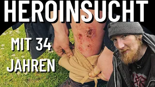 HEROINSUCHT mit 34 JAHREN ! #dortmund #drogen #heroin #sucht #heroinsucht