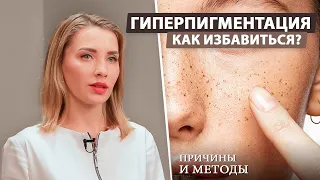 Причины и методы избавления от пигментации кожи