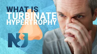 What Is Turbinate Hypertrophy | We Nose Noses