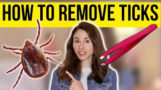 HOW TO REMOVE A TICK THE RIGHT WAY | Dermatologist @DrDrayzday