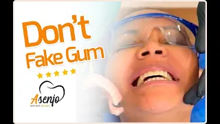 DON'T ACCEPT FAKE GUM - Punta Cana Same Day Teeth..!