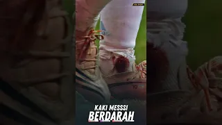 Sampe Berdarah Darah 🥲 Hari Dimana Messi Berjuang Untuk Argentina Sampe Titik Darah Terakhir