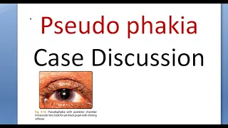 Ophthalmology Pseudophakia History Taking Examination Case Presentation Discussion IOL